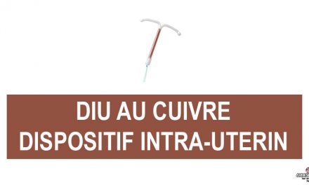 Le DIU au cuivre, le dispositif intra-utérin